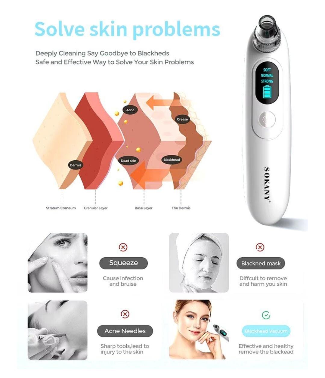 Sokany Blackhead Remover SK-319