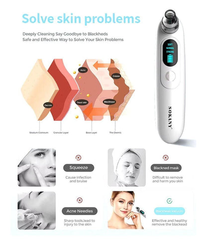 Sokany Blackhead Remover SK-319