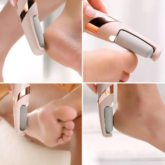 Electric Foot Callus Remover – USB Rechargeable